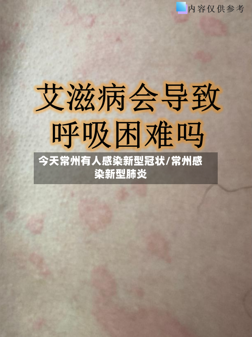 今天常州有人感染新型冠状/常州感染新型肺炎-第3张图片