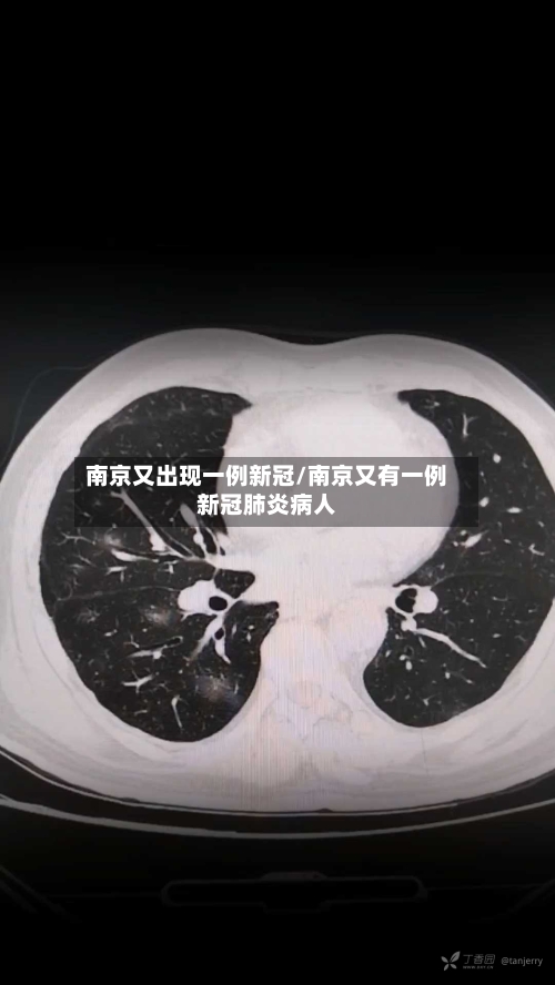 南京又出现一例新冠/南京又有一例新冠肺炎病人