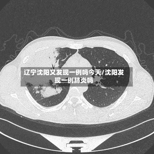 辽宁沈阳又发现一例吗今天/沈阳发现一例肺炎吗-第2张图片